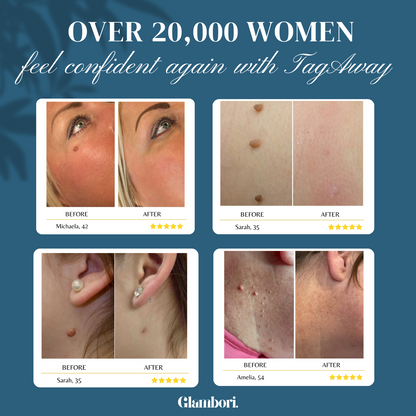 Glambori™ TagAway 2.0